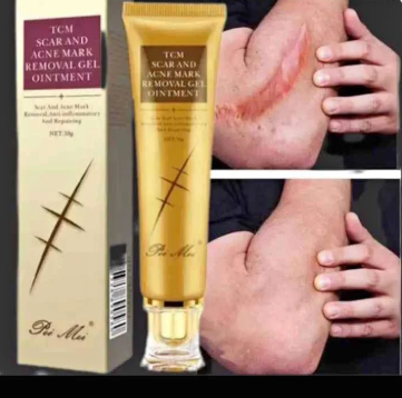 CREME ANTI - CICATRICE, VERGETURE ET ACNE